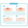 Face Spot Scar Care Treatment Stickers